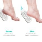 ⁦Kit de 5 Pcs Râpe de pédicure professionnelle⁩ - الصورة ⁦4⁩