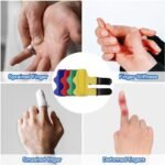 ⁦Attelle de doigt réglable avec barre en aluminium pour correction des doigts⁩ - الصورة ⁦5⁩