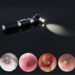 ⁦Otoscope 3X avec LED loupe de contrôle d’oreille portable avec 8 capuchons – جهاز فحص الأذن⁩ - الصورة ⁦3⁩